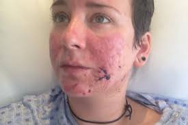 Fundraiser for Stephanie Turcotte by Danelle Chamberlin : Let Our Rae of  Sunshine Shine Again