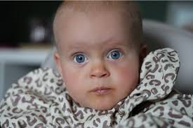 I edited this picture of my little girl and I manged to remove the food  around her mouth but I'm still left with an orange tint 🥲 how do I get rid