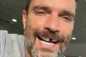 Julián Gil pierde un diente mientras grababa el reality show "La Isla:  Desafío Extremo"