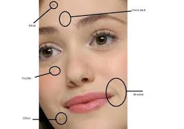A mole (or a beauty mark) may look like a freckle, but they are a bit different! Examples Of Facial Marks Scar Mole And Freckles Etc Download Scientific Diagram