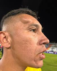 POV: Diste todo en la final por quedar campeón 💣⭐️