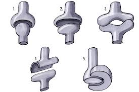 Joints 1 Ball And Socket Joint 2 Ellipsoid Joint 3 Saddle Joint 4 Hinge Joint 5 Plane Joint In 2020 Synovial Joint Joints Anatomy Bone And Joint