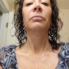 What a great and easy experience. Krave Medical Aesthetics 45 Photos 47 Reviews Medical Spas 3305 W 144th Ave Broomfield Co Phone Number Yelp