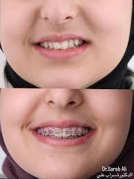 Dr.Sarab Ali_د.سراب علي‎