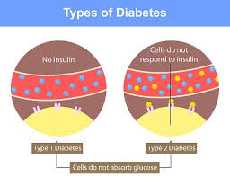 This is known as gestational diabetes. Type 1 Diabetes Medical Associates Of Northwest Arkansas