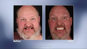 The Top Rated Hearing Aids with My Hearing Center's Dr. Enoch Cox, AUD