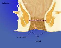 تعرف على الشرخ الشرجى بالصور الحقيقية طبيب ويب