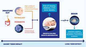 Image result for Preterm Infant Growth