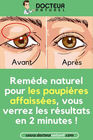 Cette Creme Naturelle Peut Avoir Litteralement Un Effet Miraculeux Contre Les Rides Astuces Beaute Naturelles Produits De Beaute Naturels Sante Et Beaute