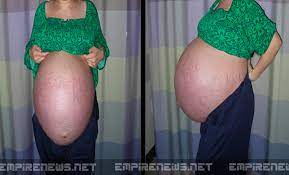 Learn more about your symptoms and how your baby is growing this week. Move Over Octomom California Woman Pregnant With 10 Babies Empire News