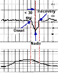 Intrapartum Fetal Heart Rate Monitoring