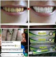 Pasta Gigi Nasa Perontok Karang Gigi Di Lapak Stockist Nasa Tangerang Bukalapak