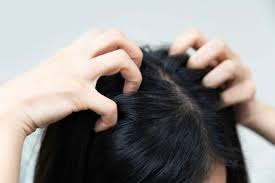 Huile De Coco Cheveux Contre Les Poux Huile De Ricin