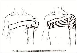 We did not find results for: Kolosovidnaya Povyazka Na Plechevoj Sustav Studopediya