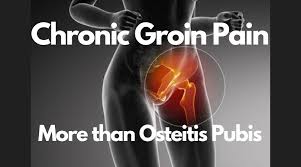 Groin pain can be acute (sudden in onset), or the pain can persist over time (chronic), depending on the specific cause. Groin Pain Archives Newcastle Sports Medicine