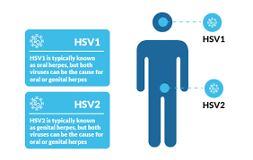Herpes simplex virus is common in the united states. Genital Warts Vs Herpes What S The Difference