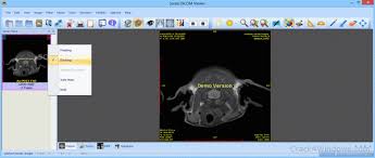 How To Crack Sante Dicom Viewer Pro
