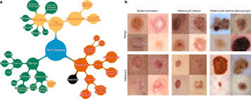 If you've received a diagnosis, here are some things you need to know about the condition. Dermatologist Level Classification Of Skin Cancer With Deep Neural Networks Nature