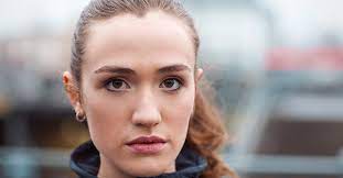 Widow S Peak Hair Causes Myths Overview What You Need To Know