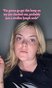 Swollen Lymph Nod Jawline