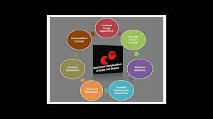 Nutrition In Sickle Cell Disease Recent Insights Nds
