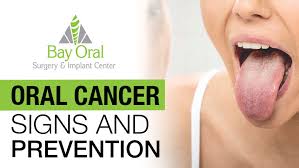 Mris use radio waves and strong magnets to take detailed pictures that reveal more about the cancer size. April Is Oral Cancer Awareness Month Bay Oral Surgery Implant Center