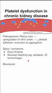 Image result for Platelet Dysfunction