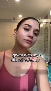 i feel like a teenager again in the worst way possible #acne #breakout  #skincare #grwmroutine #grwmmakeup @urban decay @JOAH Beauty @Charlotte  Tilbury @NARS Cosmetics @bareMinerals @Physicians Formula