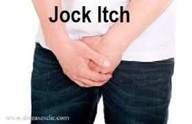 Jock Itch Causes Symtoms Treatment And Prevention