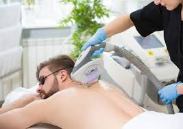 Image result for Laser Hair Reduction