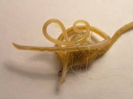Several types of worms can infect cats. Toxocara Cati Wikipedia