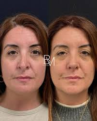 פרופיל של ‏‎Dra Beatriz Moralejo‎‏‎