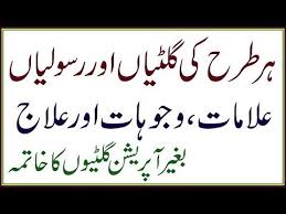 Gilti Ki Alamat Wajohat Aur Asan Gharelu Ilaj Rasoli Ka Ilaj Gilti Ka Totka Youtube Islamic Page Pcos Health And Beauty Tips