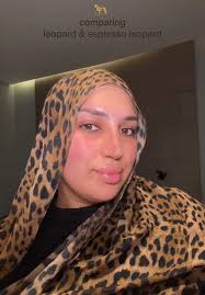 Difference Between Regular Leopard and Espresso Leopard