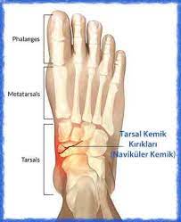 kirik panosundaki pin