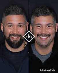 Dr Alex Carruthers (@dr.alexcaffufle) • Instagram photos and videos