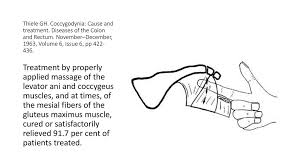 George thiele, md, published several articles relating to coccyx pain as early as 1930 and into the late 1960's. Chronic Pain And Neuromusculoskeletal Conditions Ppt Download