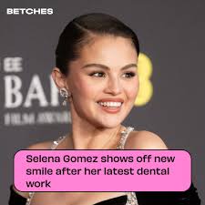 New fiancé means new teeth 😁