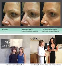 Veronica Barton Schwartz, Author at Veronica Spa and Skin Care Center,  Malibu, California