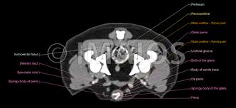 Check spelling or type a new query. Abdomen Und Beckenanatomie Des Ruden Im Ct