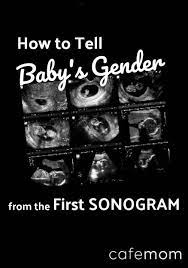 At about 9 or 10 weeks of pregnancy you might be able to hear your babys heartbeat. 6 Ways To Tell Baby S Gender From An Early Sonogram Cafemom Com
