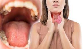 The most common early symptom of tongue cancer is a sore on your tongue. Mouth Cancer If A Person Feels A Certain Feeling In Their Mouth It Could Mean You Are At Express Co Uk