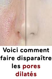 Voici Comment Faire Disparaitre Les Pores Dilates Anti Aging Oils Skin Beauty Tips For Face