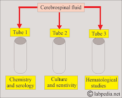 Image result for CSF Culture