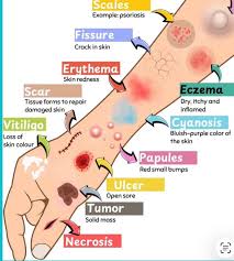 Image result for Comprehensive Skin Integrity Assessment