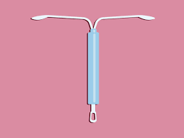 We did not find results for: The Truth About Getting Pregnant When You Have An Iud Self