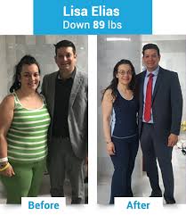 Your surgeon should discuss all risks before you have surgery so that you know what complications are possible. Mini Gastric Bypass