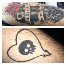 The dancehall hitmaker posted a new photo of himself on the weekend showing his eyes looking brand new. I Saw We Were Posting Tattoos My Wife Has The Coffin One As Well Alkalinetrio
