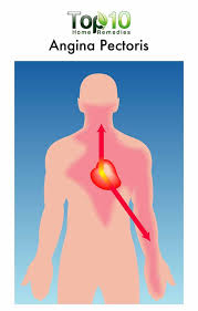 Pin On Natural Remedies