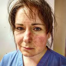 realheros #nurses #rcn #nhs